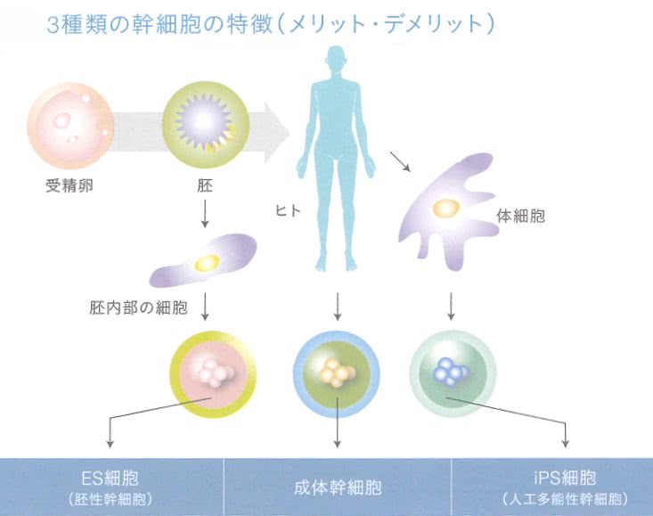 日本脂肪干细胞与其他干细胞的区别与优势