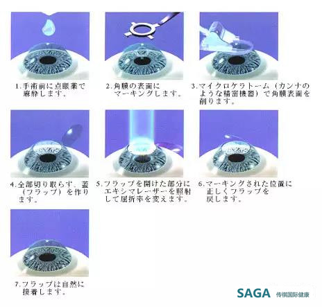 文章附图